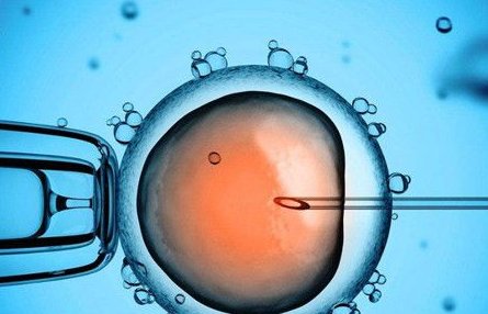 男性不育精子畸形做第几代试管婴儿比较好？