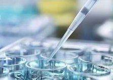 痛风不能吃哪些蔬菜？这七种食物大忌